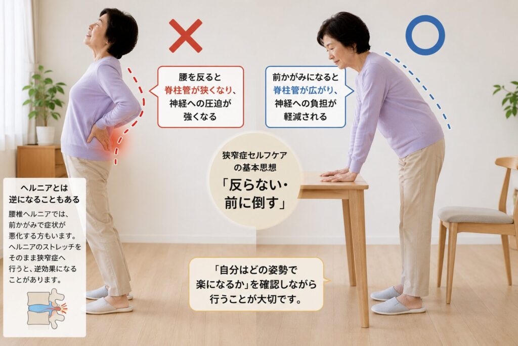 脊柱管狭窄症で腰を反らす姿勢と前かがみ姿勢による負担の違いを比較したイメージ