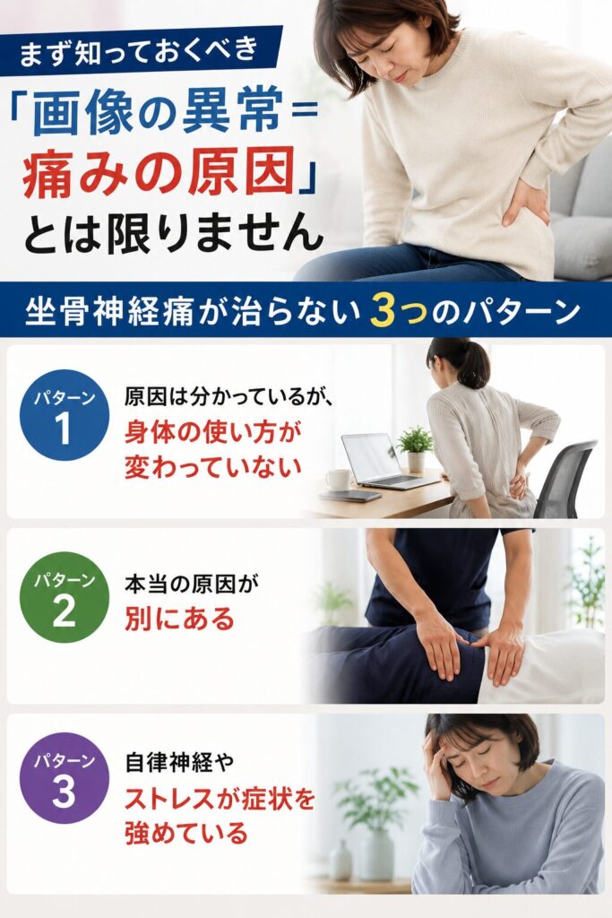 坐骨神経痛が治らない原因として身体の使い方・本当の原因・自律神経やストレスを解説した図
